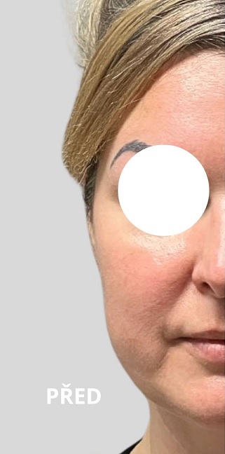 Vor dem Eingriff
