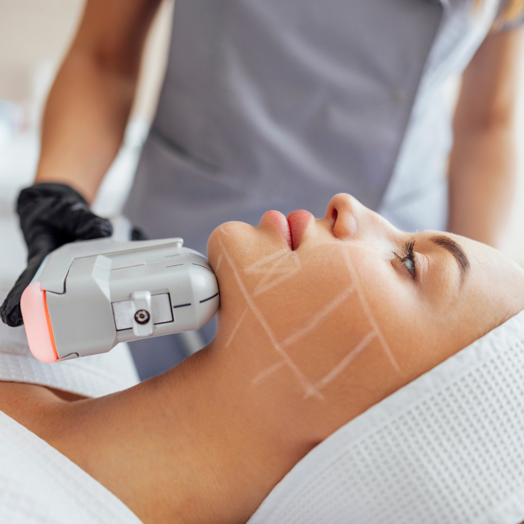 Ultrasound HIFU