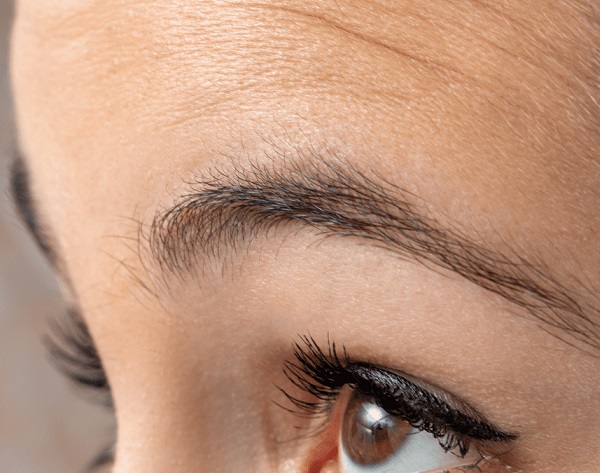 Browlift (Brow and Forehead Lift)