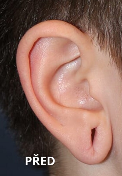 Before procedure