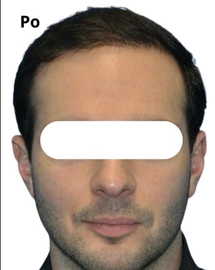 After procedure