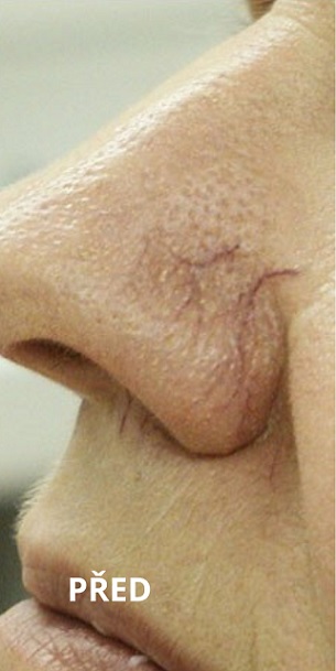 Before procedure
