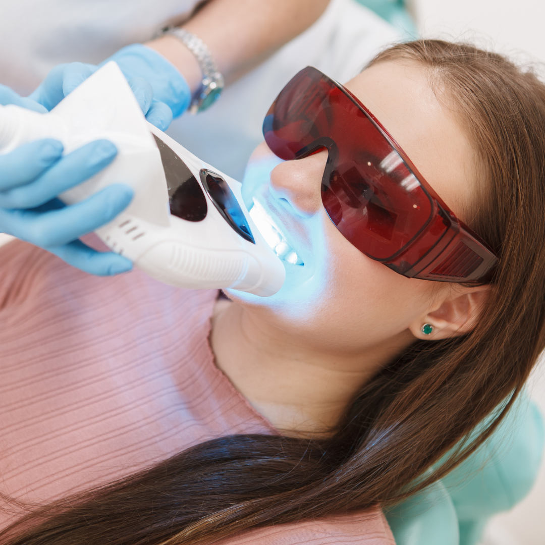 In-Office Teeth Whitening