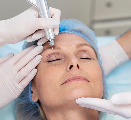 How to Lift Drooping Eyelids?