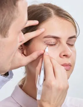 Víčka