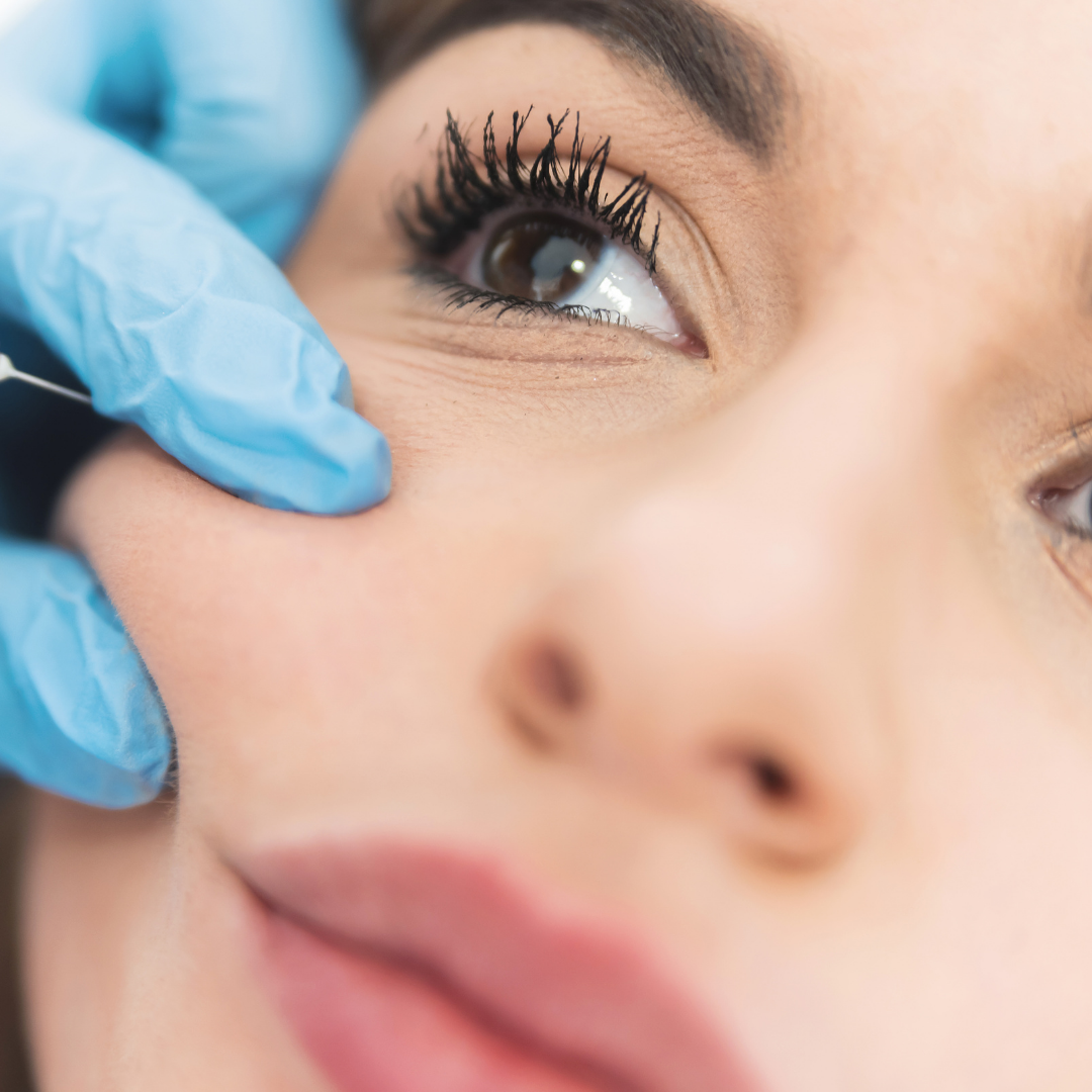 Facelift v Medical Institutu v Plzni