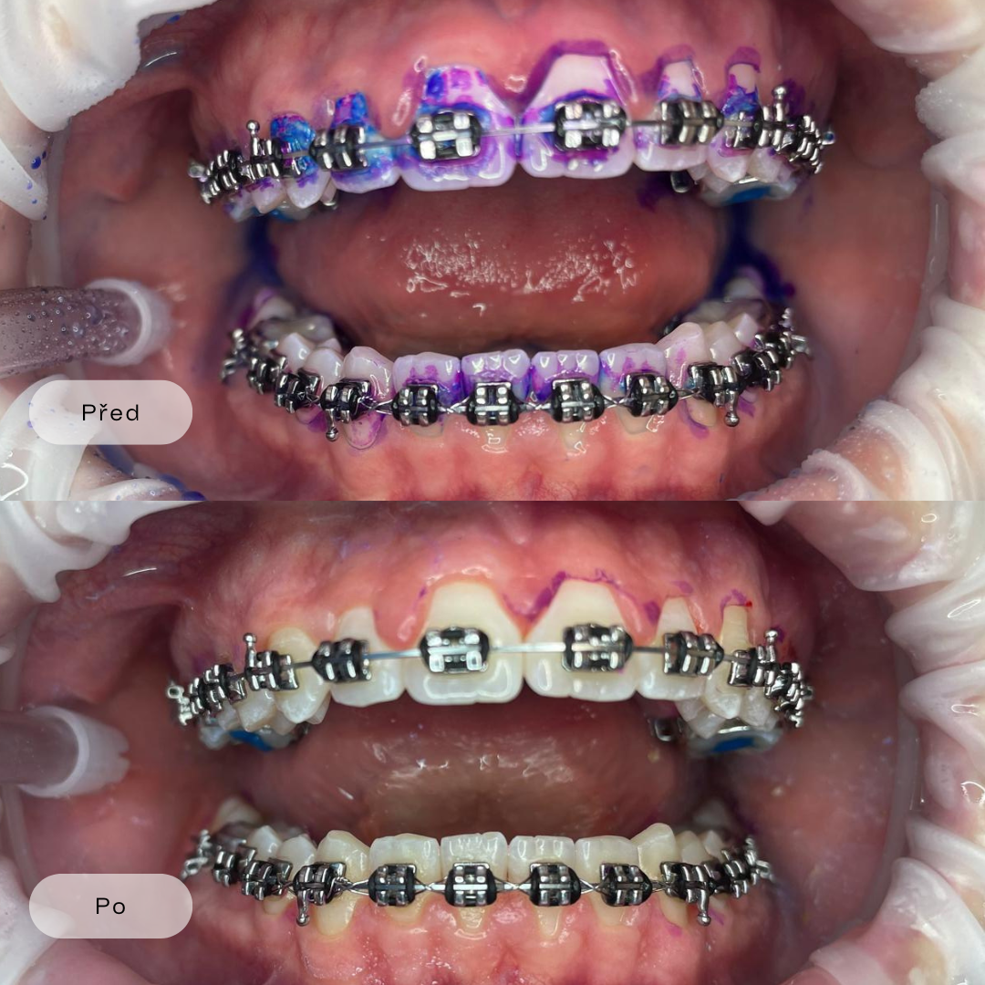 Dentální hygiena