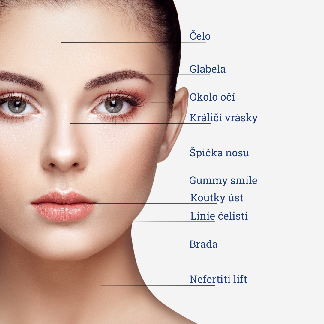 Botulotoxin